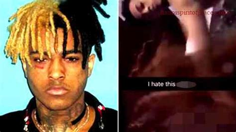 xxx tentacion autopsy pic|X’s autopsy : r/XXXTENTACION